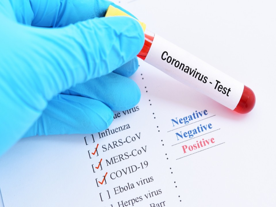COVID-19 Diagnostics Market Report 2021, Size, Share, Trends, Analysis and Forecast till 2026