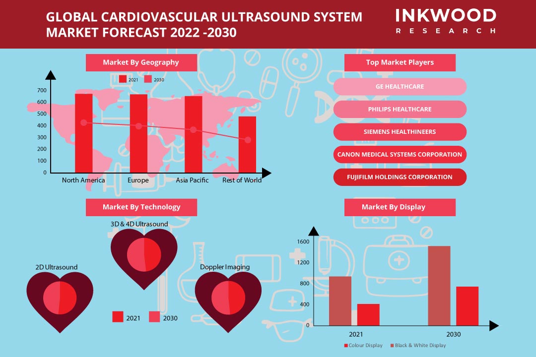 Technological Advancements augment Global Cardiovascular Ultrasound Market Growth