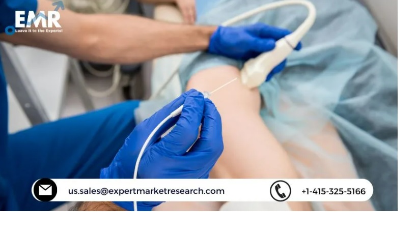 Global Catheter Stabilization Device/Catheter Securement Device Market Size, Share, Price, Trends, Growth, Analysis, Key Players, Outlook, Report, Forecast 2022-2027 | EMR Inc.