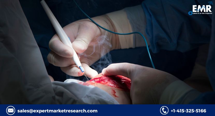 Global Electrosurgery Market Share, Size, Price, Trends, Growth, Analysis, Key Players, Outlook, Report, Forecast 2022-2027 | EMR Inc