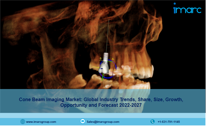 Cone Beam Imaging Market Expected to Reach US$ 1,193.6 with CAGR of 9.4% by 2027