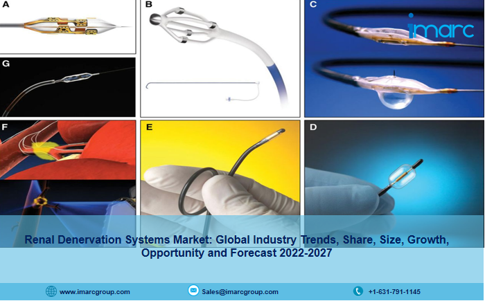 Renal Denervation Systems Market to Reach US$ 1,723.6 Million by 2027, with a CAGR of 40.67%