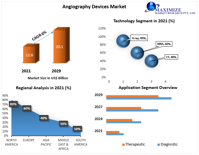 Angiography Devices Market worth USD 20.1 Bn. by 2029: Growth, Size, Share, Trends, Forecast, and Supply Demand to 2029