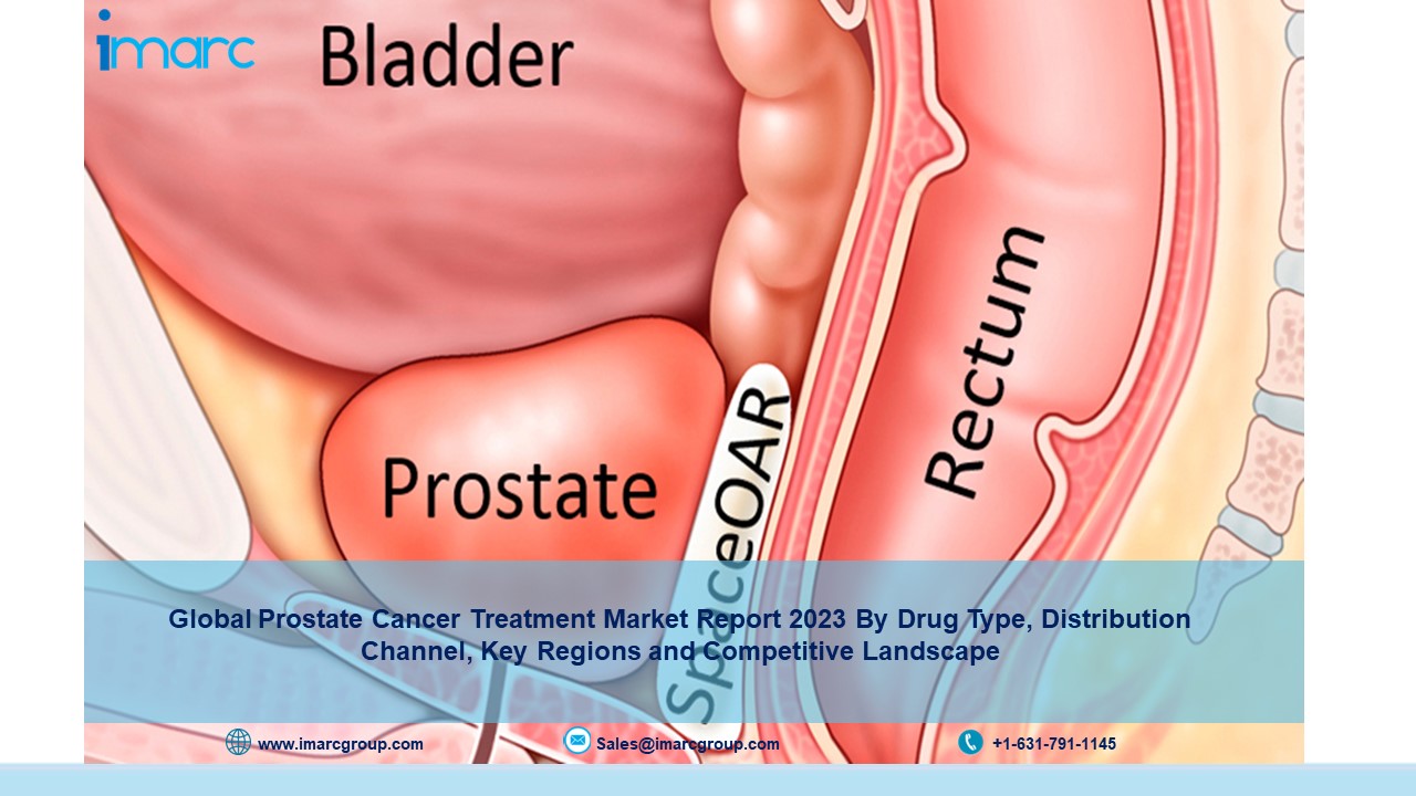 Prostate Cancer Treatment Market Size Expected to Reach US$ 10.3 Billion by 2028 | Globally, Growth Rate (CAGR) of 5.8%