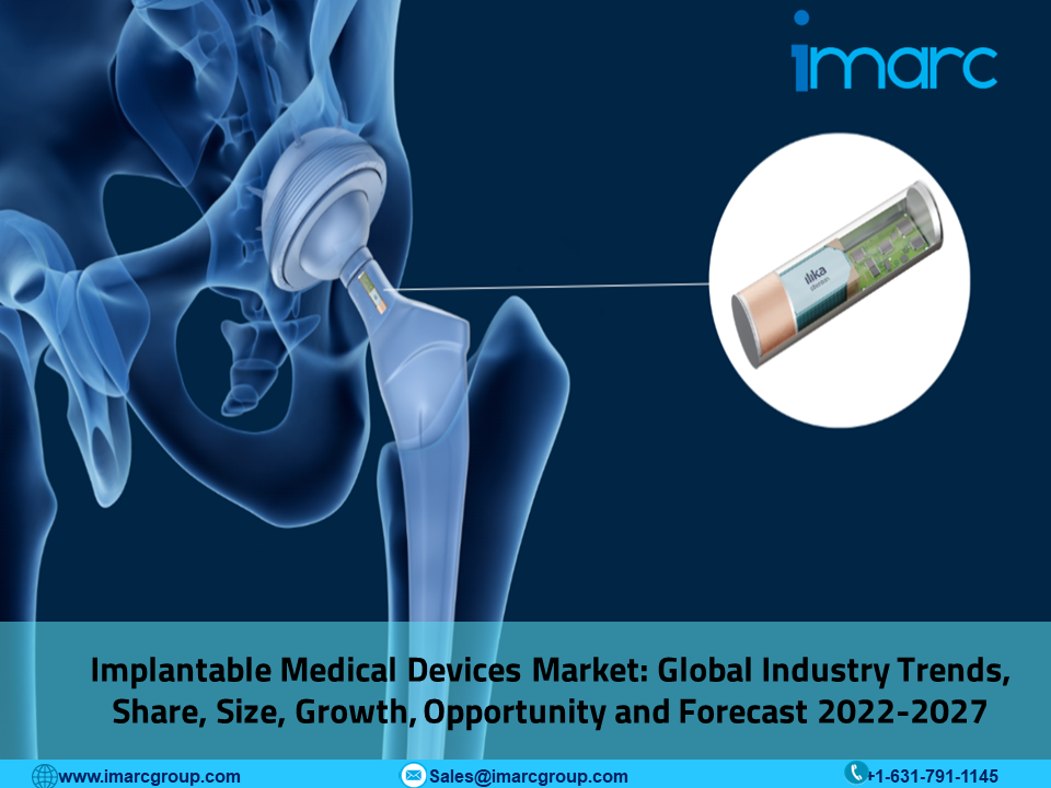 Implantable Medical Devices Market Size is Projected to Reach US$ 168.3 Billion by 2027, Industry CAGR 5.54% | IMARC Group