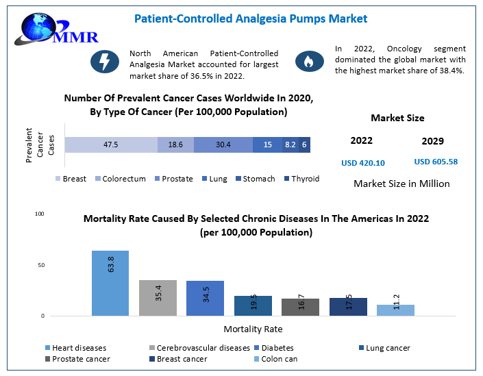 Patient-Controlled Analgesia Pumps Market to hit USD 605.58 Mn by 2029 at a CAGR of 5.4 percent, Regional Insights and Global Trends