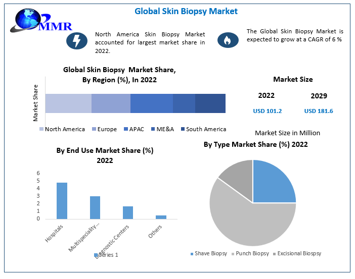 Skin Biopsy Market size to hit USD 181.6 Mn by 2029 at a CAGR of 6 percent - Says Maximize Market Research