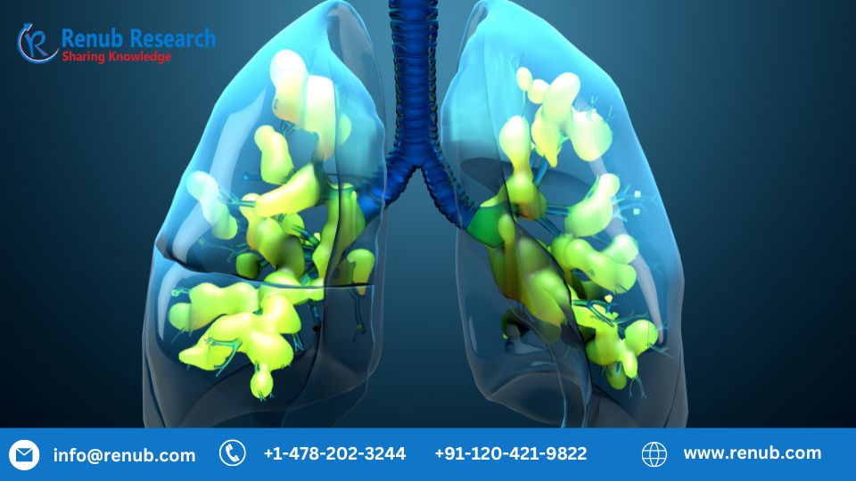 Acute Respiratory Distress Syndrome Market, Global Forecast