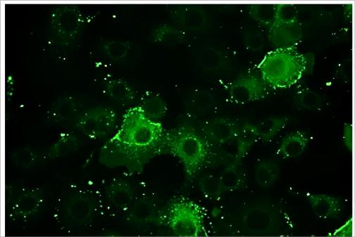 Creative Diagnostics Introduces Immunofluorescence Assay Testing Services for Virology Research