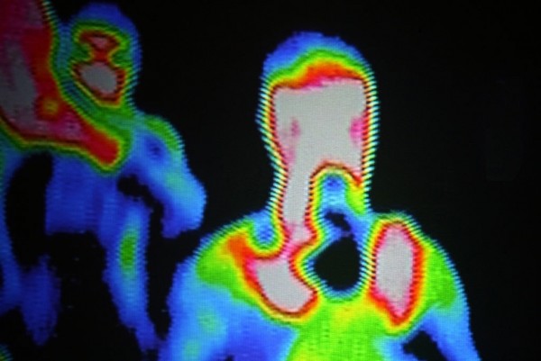 Thermal imaging